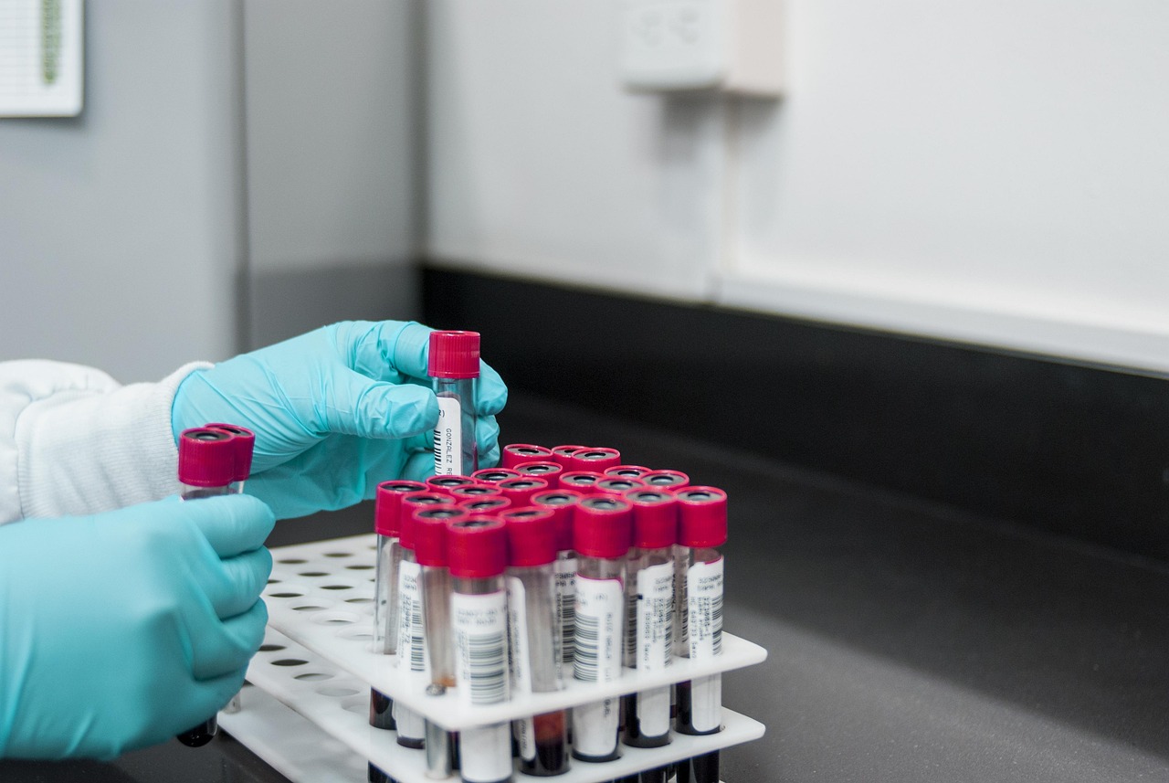 biotech laboratory pipette life sciences